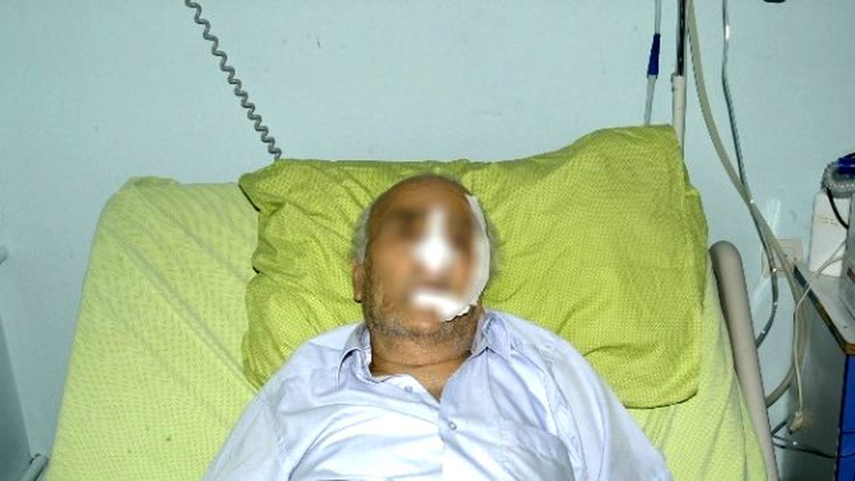 Kocasına Bastonla Vurup Hastanelik Etti