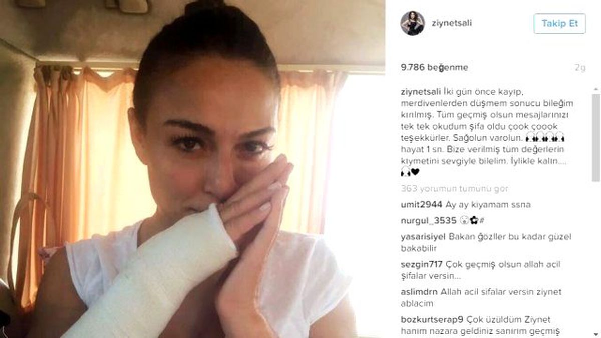 Ziynet Sali Bileğini Kırdı