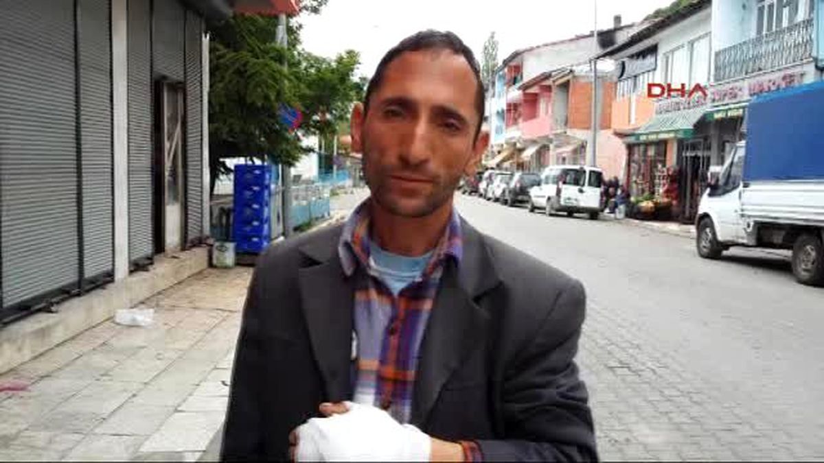 Saldıran Kurdu Bıçaklayarak Canını Kurtardı