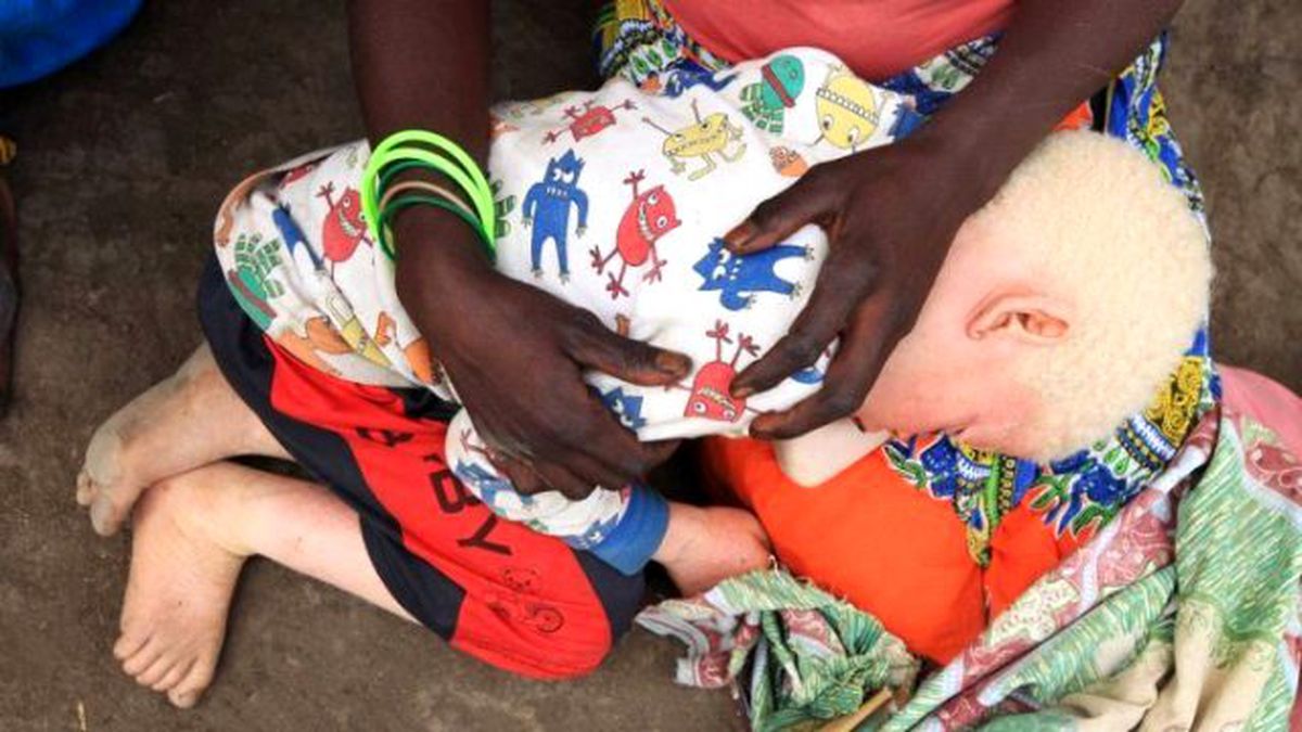 Annesinin Kucağından Çalıp Parçalara Ayırdılar