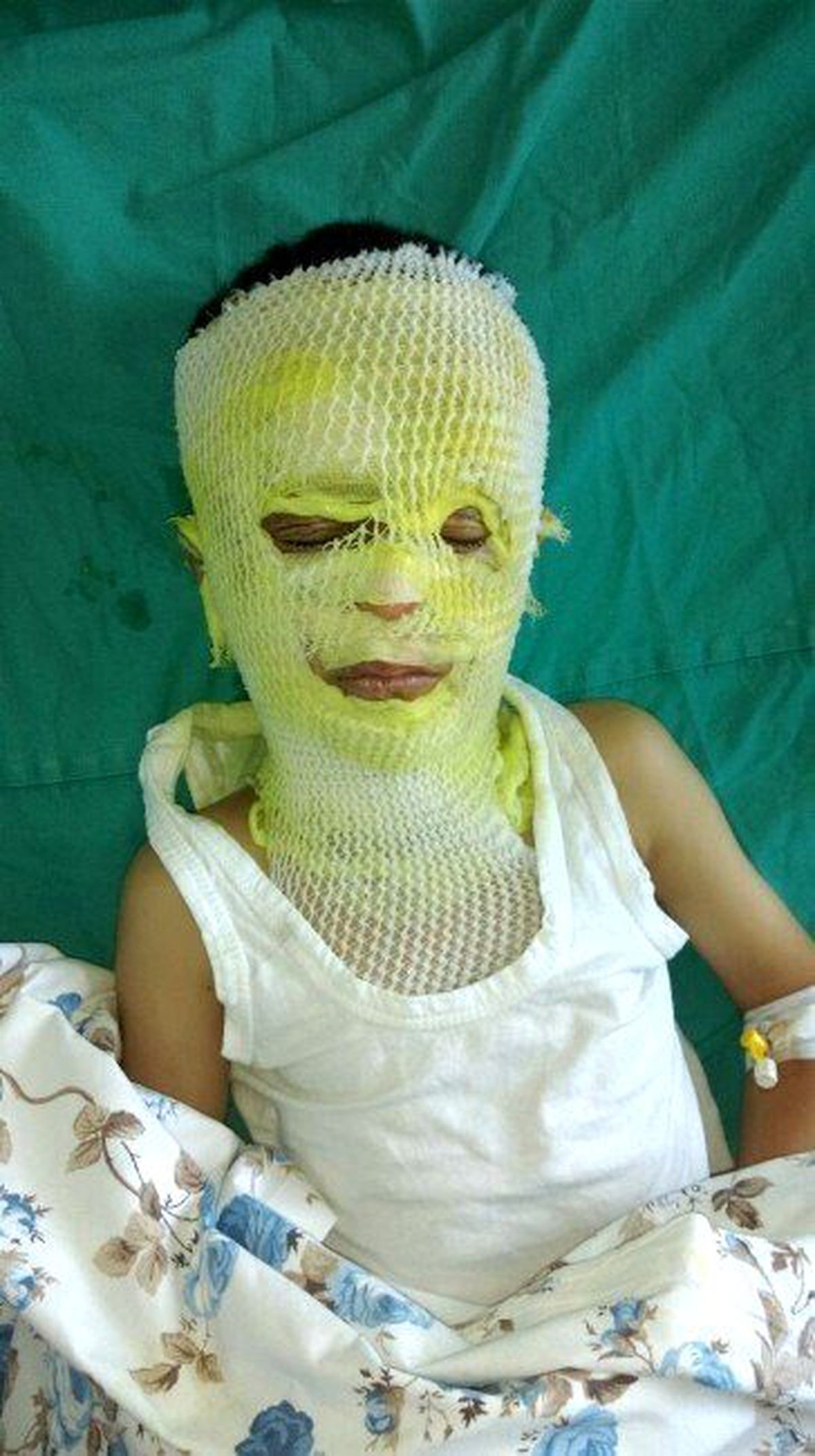 Çatapat ve Barutlu Mantar Karışımı Bu Hale Getirdi