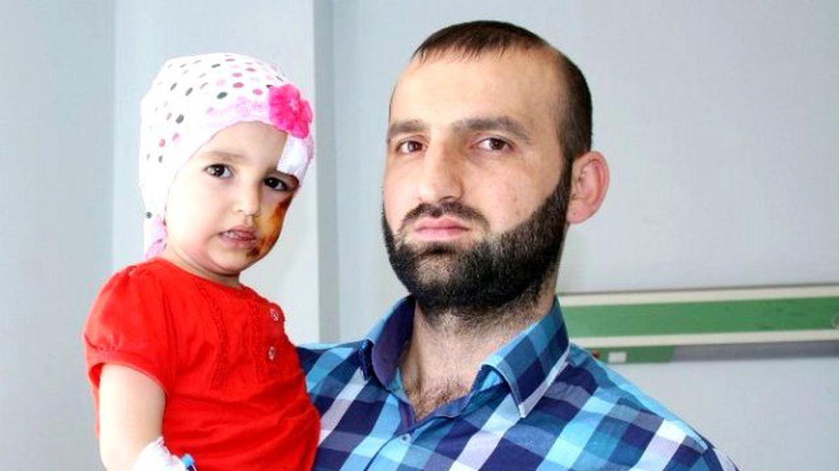Samsun'da İkinci Kattan Düşen Çocuğun Sağlık Durumu İyi
