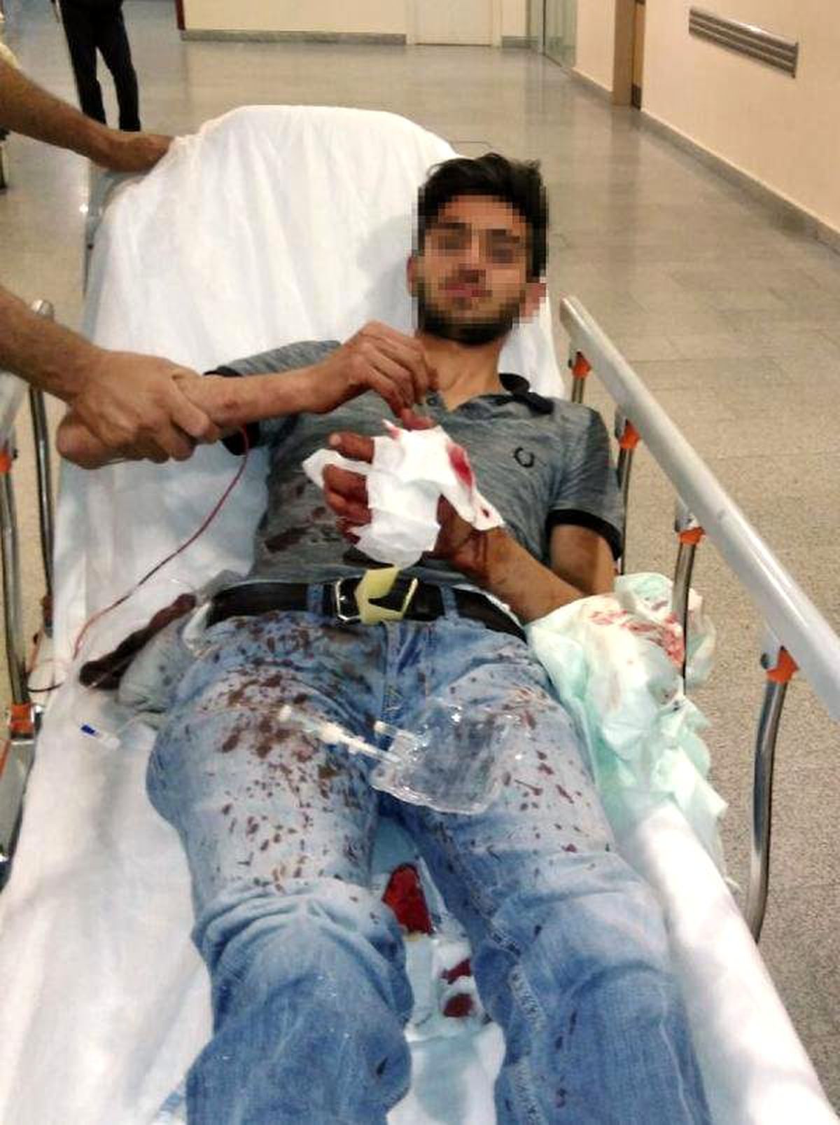 Hazırladıkları El Yapımı Bomba Ellerinde Patladı