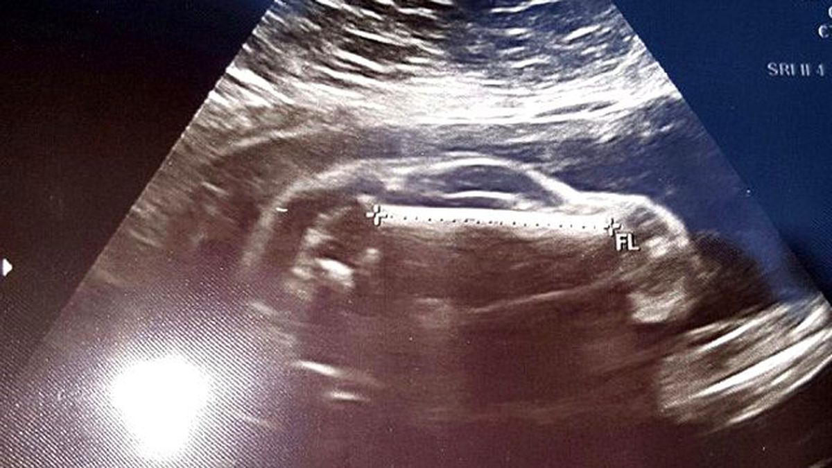 Baba Olmaya Hazırlanan Adam: Karım Bir Spor Arabaya Hamile