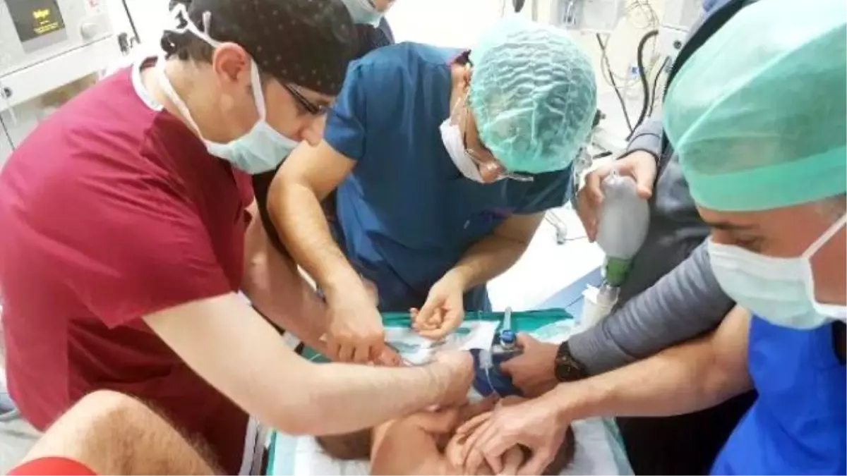 Şanlıurfa'da Yapışık İkizler Ameliyatla Ayrıldı