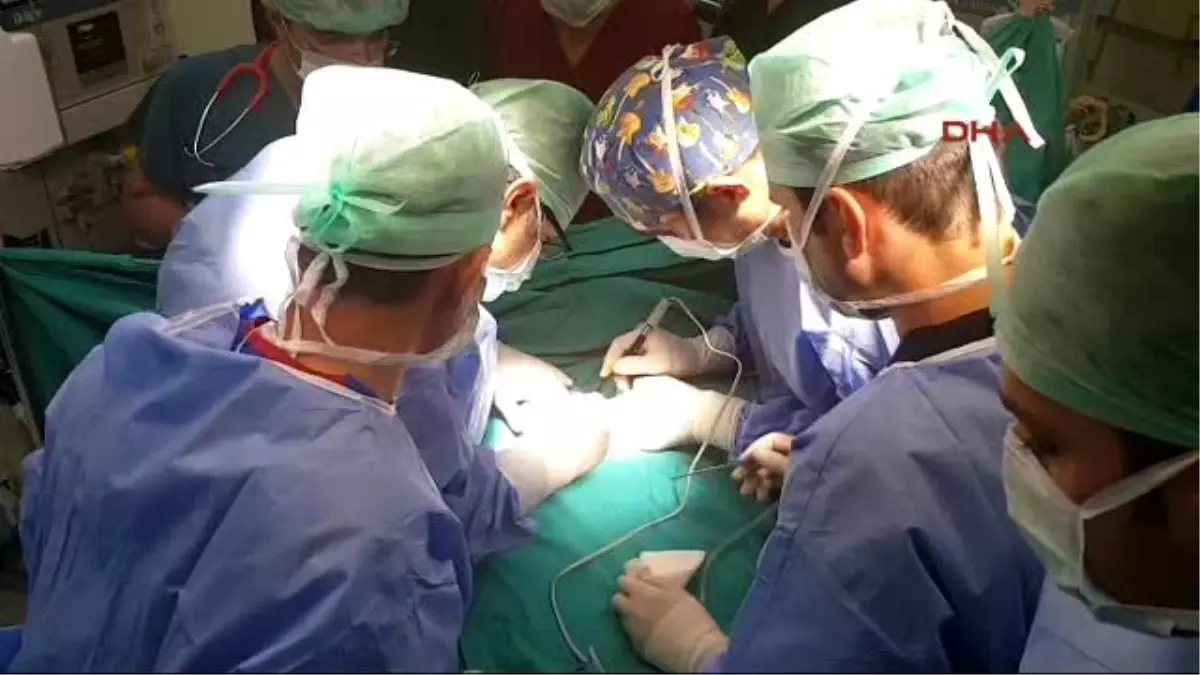 Şanlıurfa?da Yapışık İkizler Ameliyatla Ayrıldı