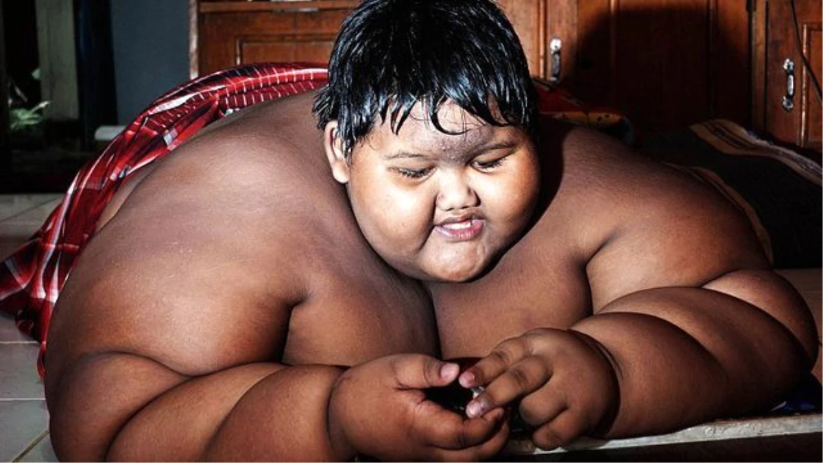 Dünyanın En Kilolu Çocuğu 10 Yaşında ve 192 Kilo