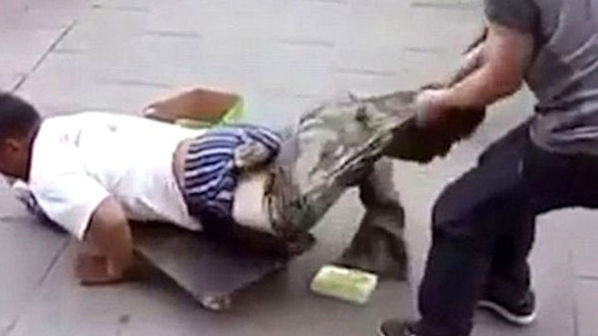 Dilencinin Pantolonunu Çıkarınca Gerçek Ortaya Çıktı