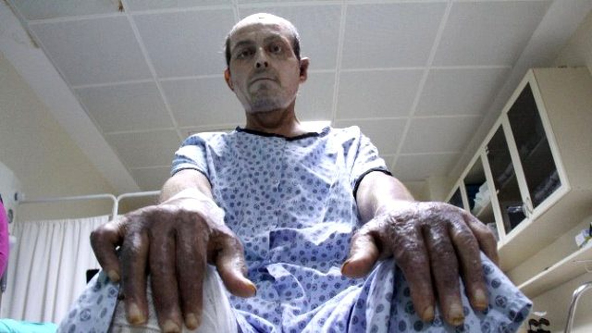 Alevlerin Arasından Çıkarak İkinci Hayatlarına Tutundular