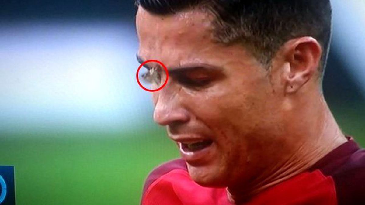 Ronaldo'nun Yüzüne Konan Güve, Dalga Konusu Oldu
