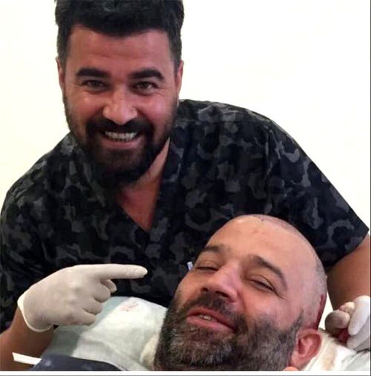 Şevket Çoruh saç ektirdi, son halini görenler tanıyamayacak