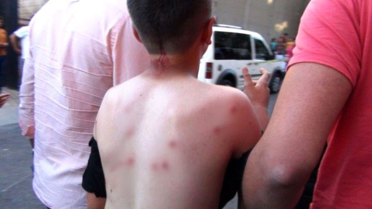 Gaziantep\'te Bir Araçtan Rastgele Ateş Açıldı: 1 Ölü, 3 Yaralı