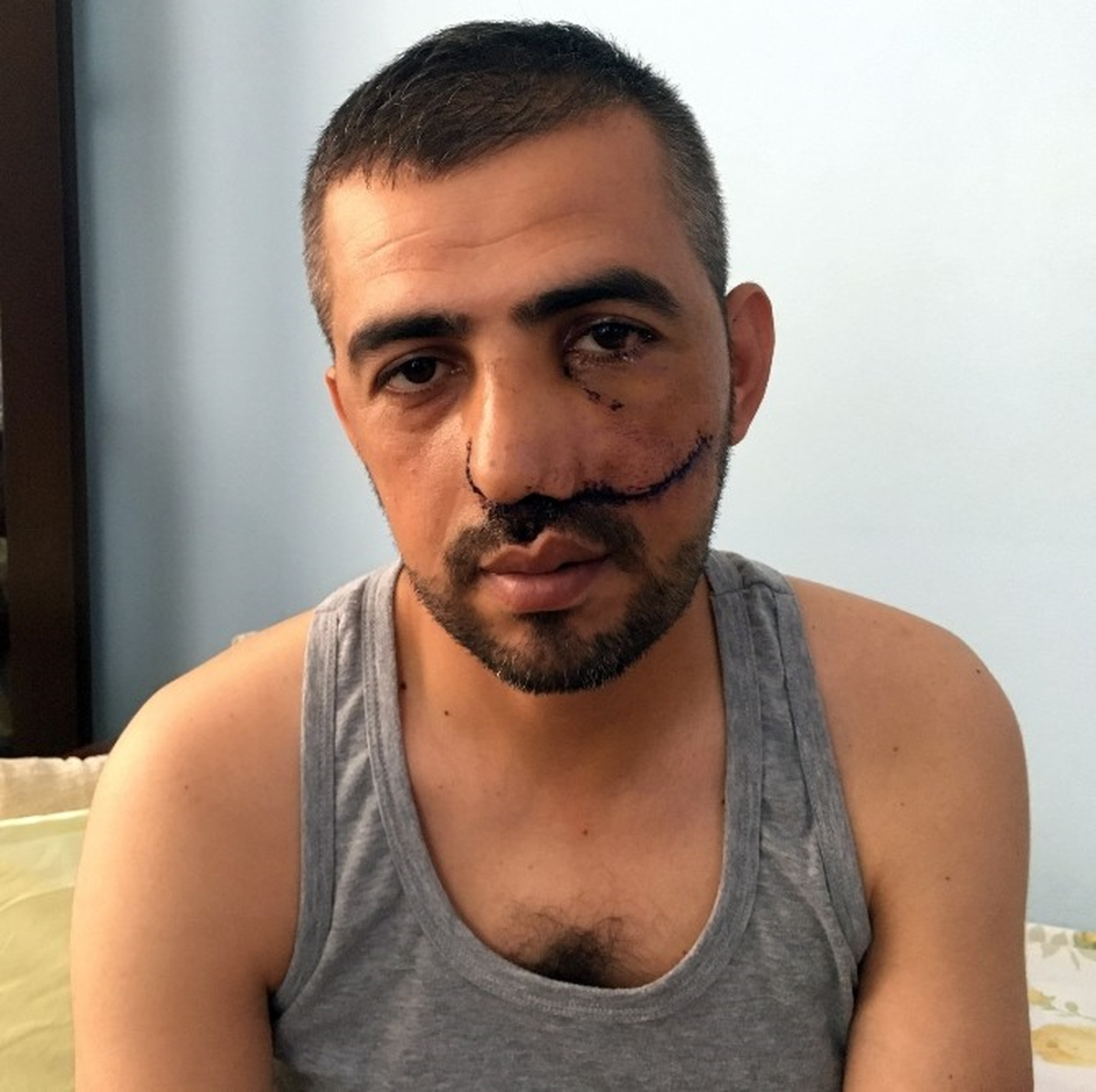 Boğaziçi Köprüsü\'nde Yaralanan Hamit Hakan Yılmaztürk, O Anları Anlattı Açıklaması
