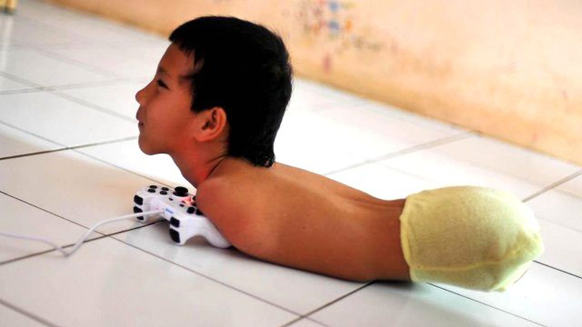 Hayata Sadece Gövdesiyle Tutunuyor