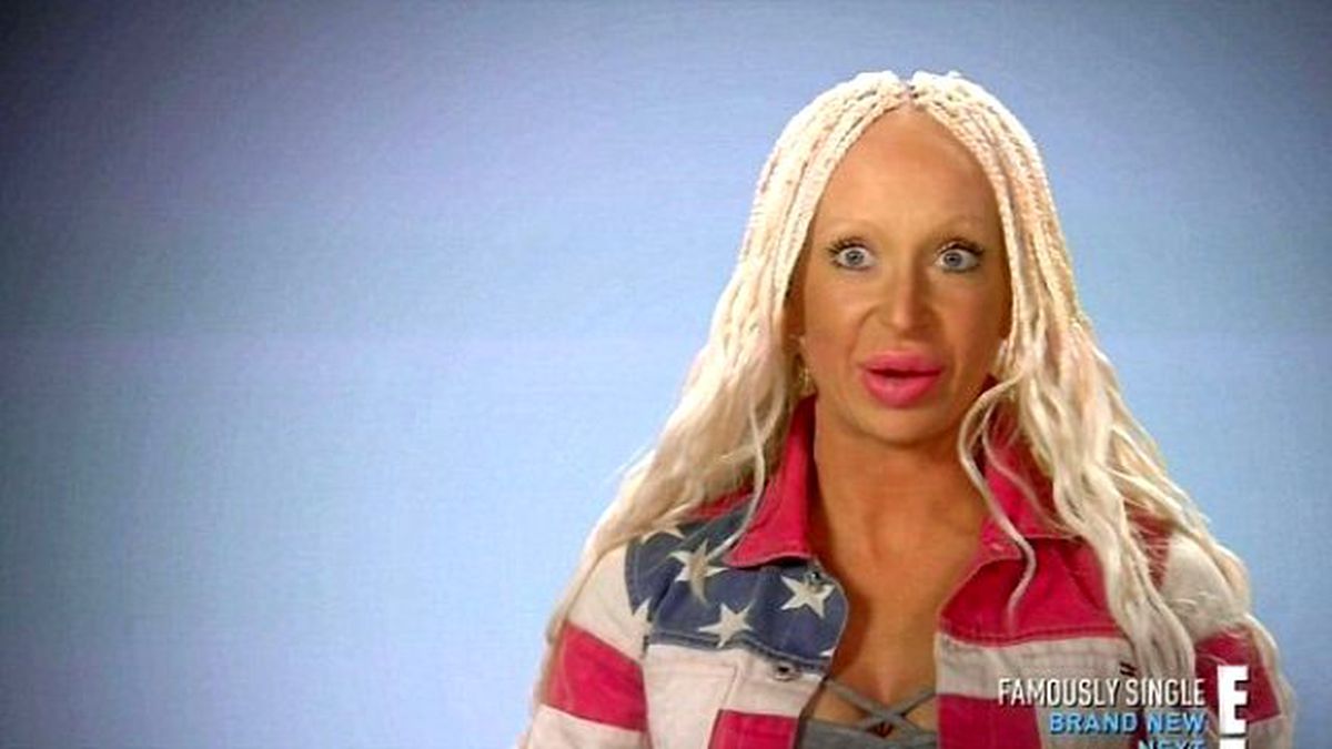 Dudaklarındaki Büyümeyi Durduramayan Kadın Eski Haline Kavuştu