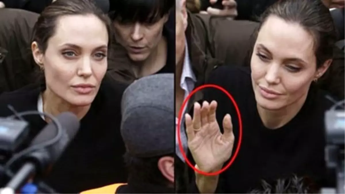 Kadınlar, Angelina Jolie\'nın olduğu gibi ameliyat istiyor