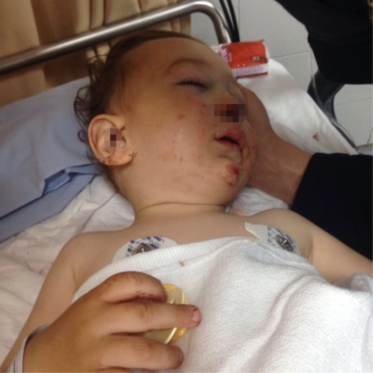 Ankara\'da 16 Aylık Bebek 3. Kattan Merdiven Boşluğuna Düştü