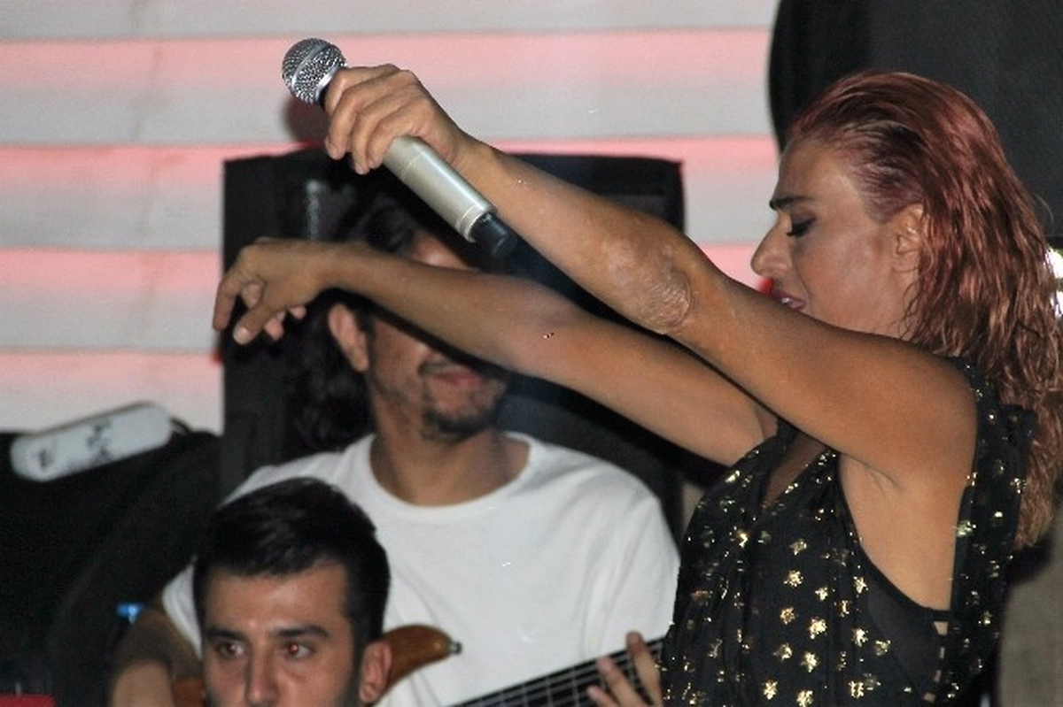 Yıldız Tilbe'nin Kollarındaki Lekeler Dikkat Çekti