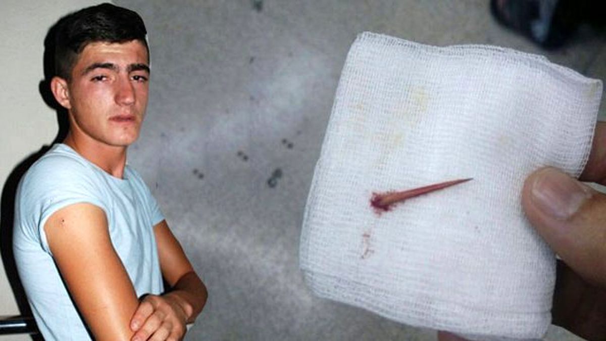 Batan Diken Nedeniyle Az Kalsın Kolunu Kaybediyordu