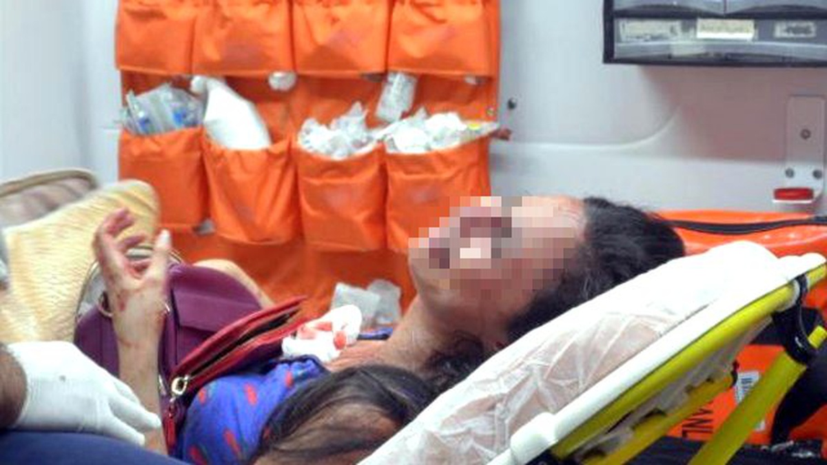 Galerici Sevgili, Tartıştığı Genç Kadının Burnunu Kırdı