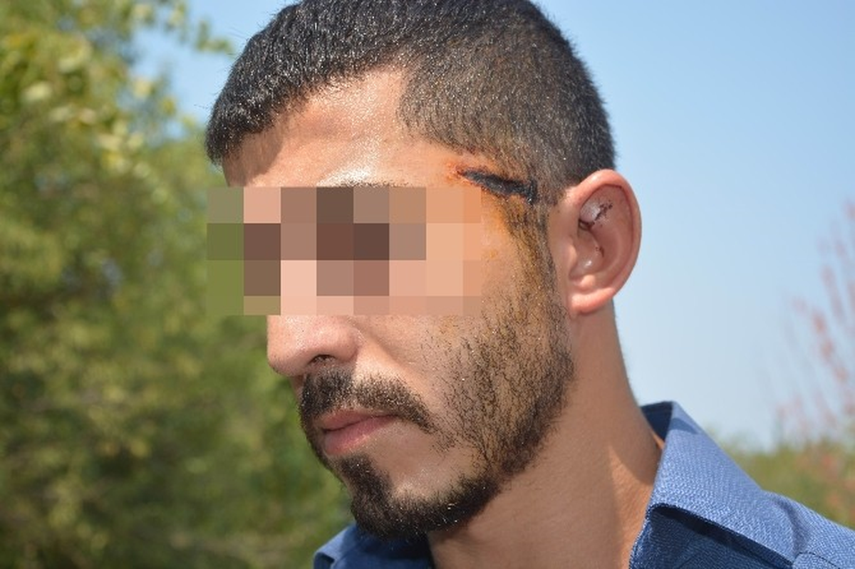 Tartıştığı Şahsı Öldüren Firari Şüpheli Teslim Olmadan İha\'ya Konuştu