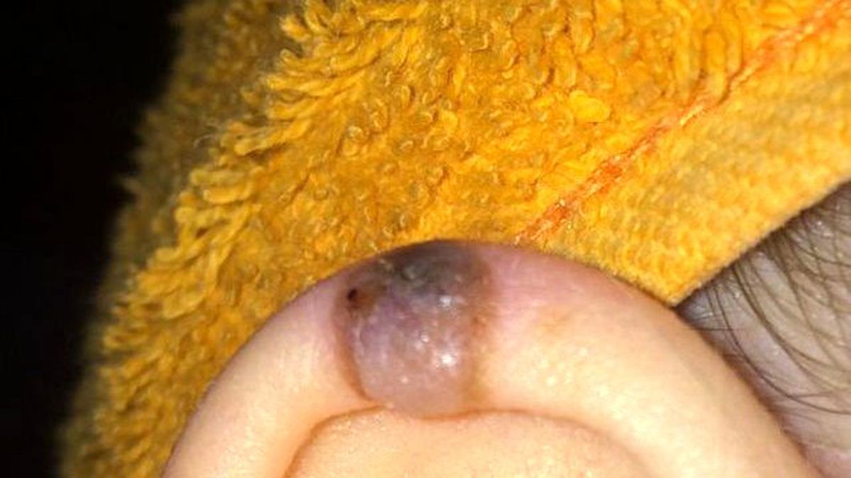 Kulağındaki Siyah Leke Hayatını Kararttı