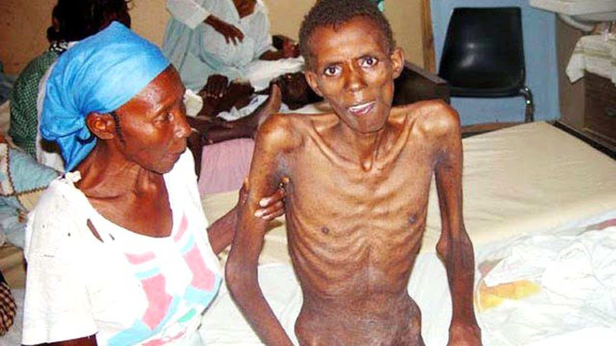 Kenya\'da Her Gün 14 Kişi Aıds\'den Ölüyor
