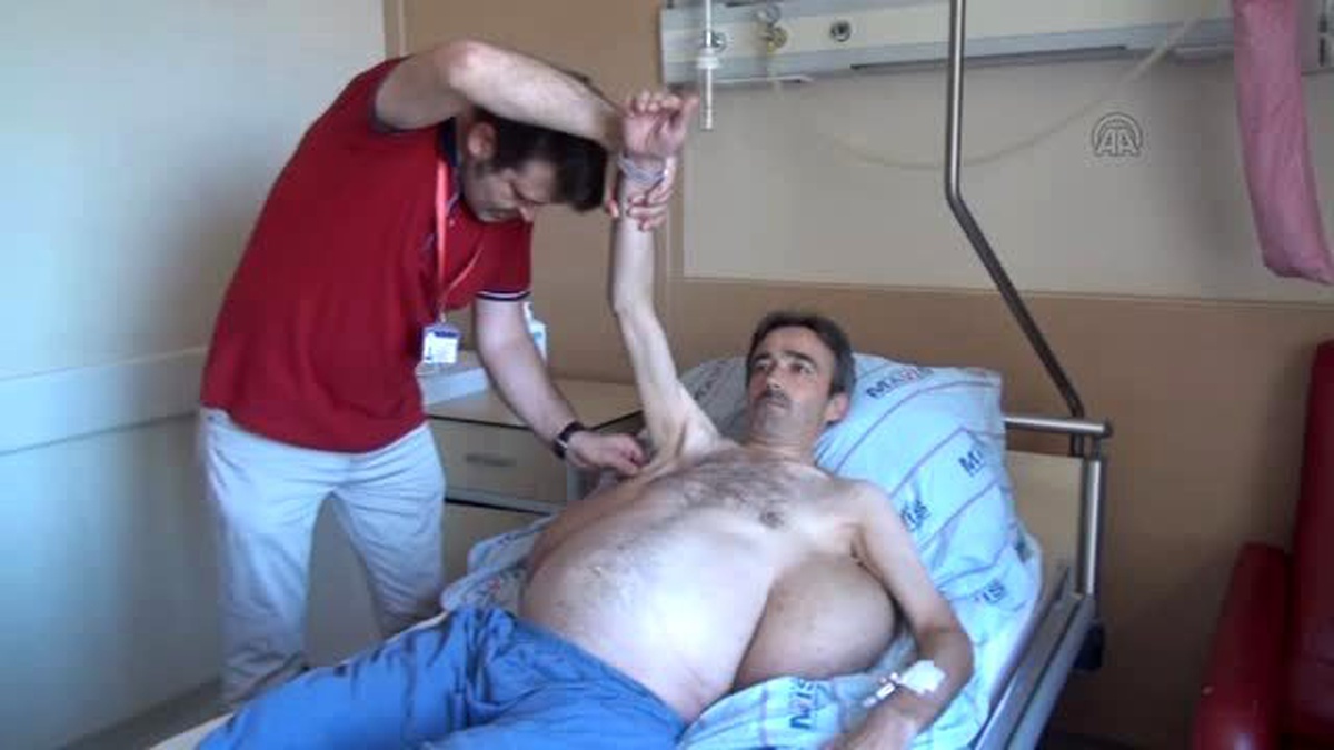 Sırtındaki 25 Kiloluk "Yük"Ten 30 Yıl Sonra Kurtuldu