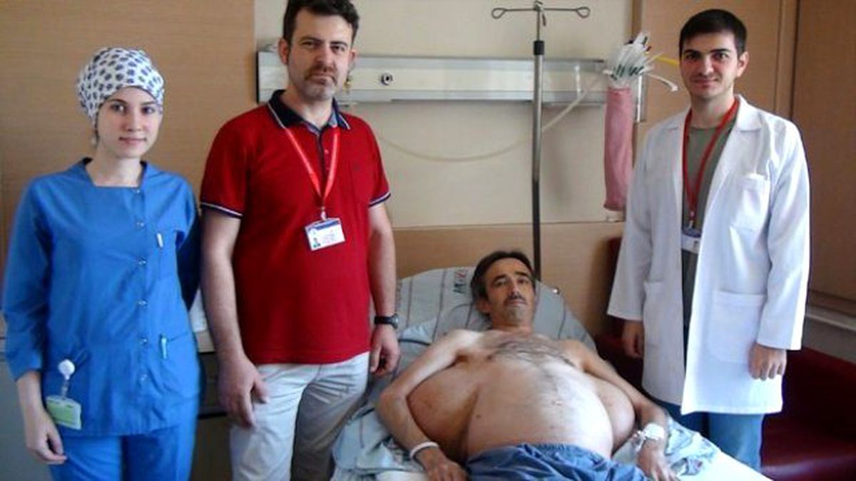 Sırtındaki 25 Kiloluk 'Yük'ten 30 Yıl Sonra Kurtuldu