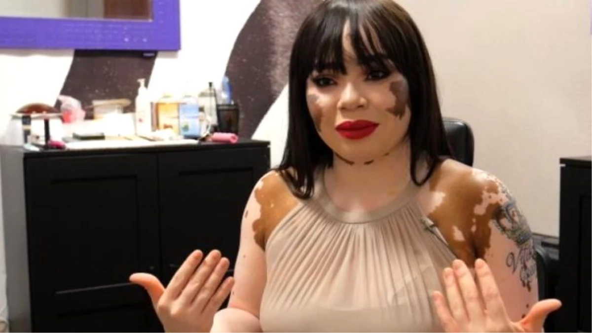 Vitiligo Hastası Kadın Makyaj Sanatçısı Oldu