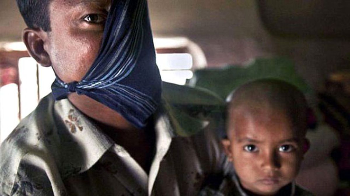 Yüzünün Yarısını Kaplan Saldırısında Kaybetti