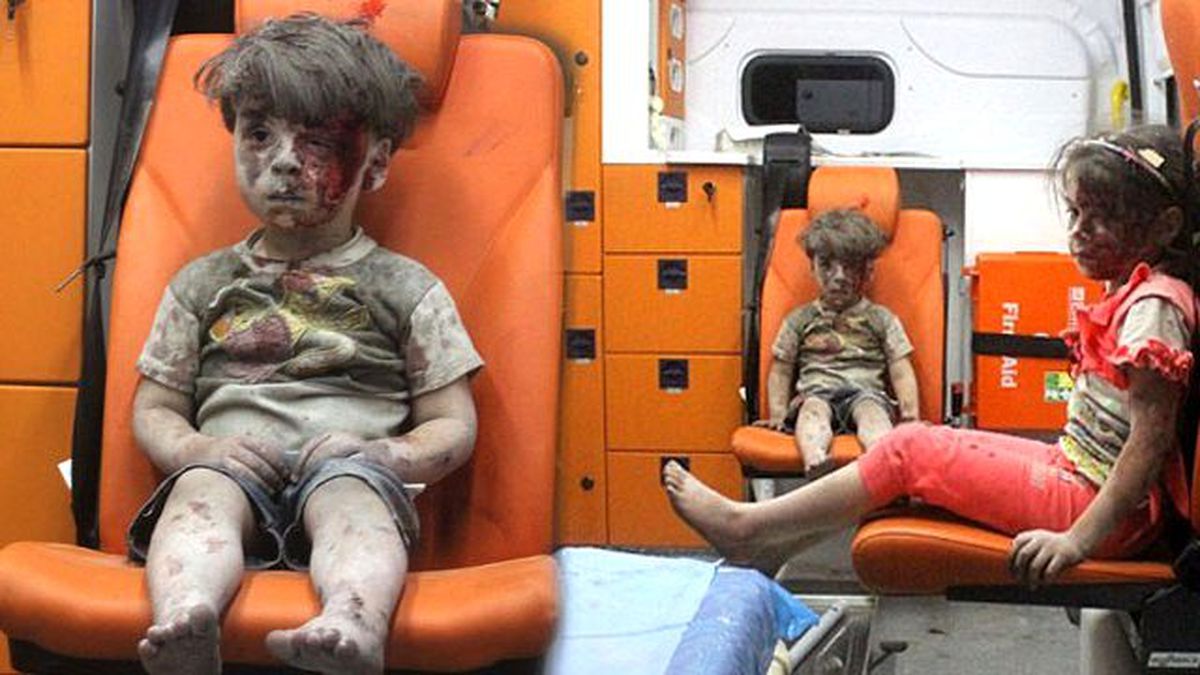 Suriye Savaşının Sembolü Olan Umran Ailesine Kavuştu