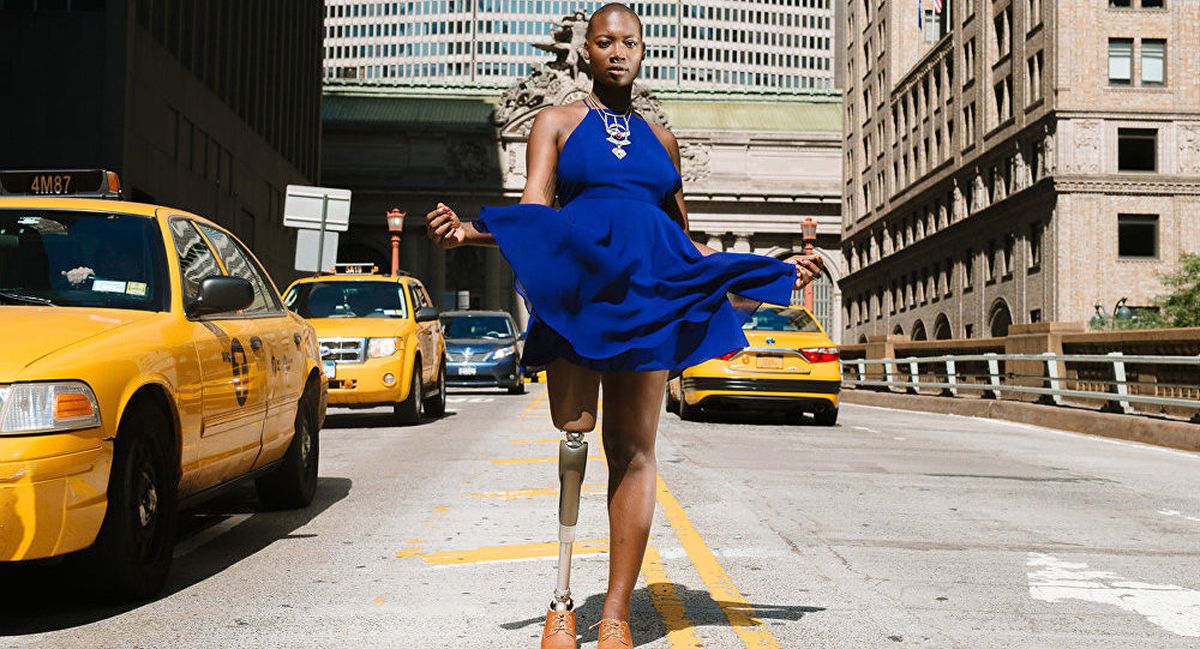 Tek Bacaklı Mama Cax'ın İlham Verici Öyküsü