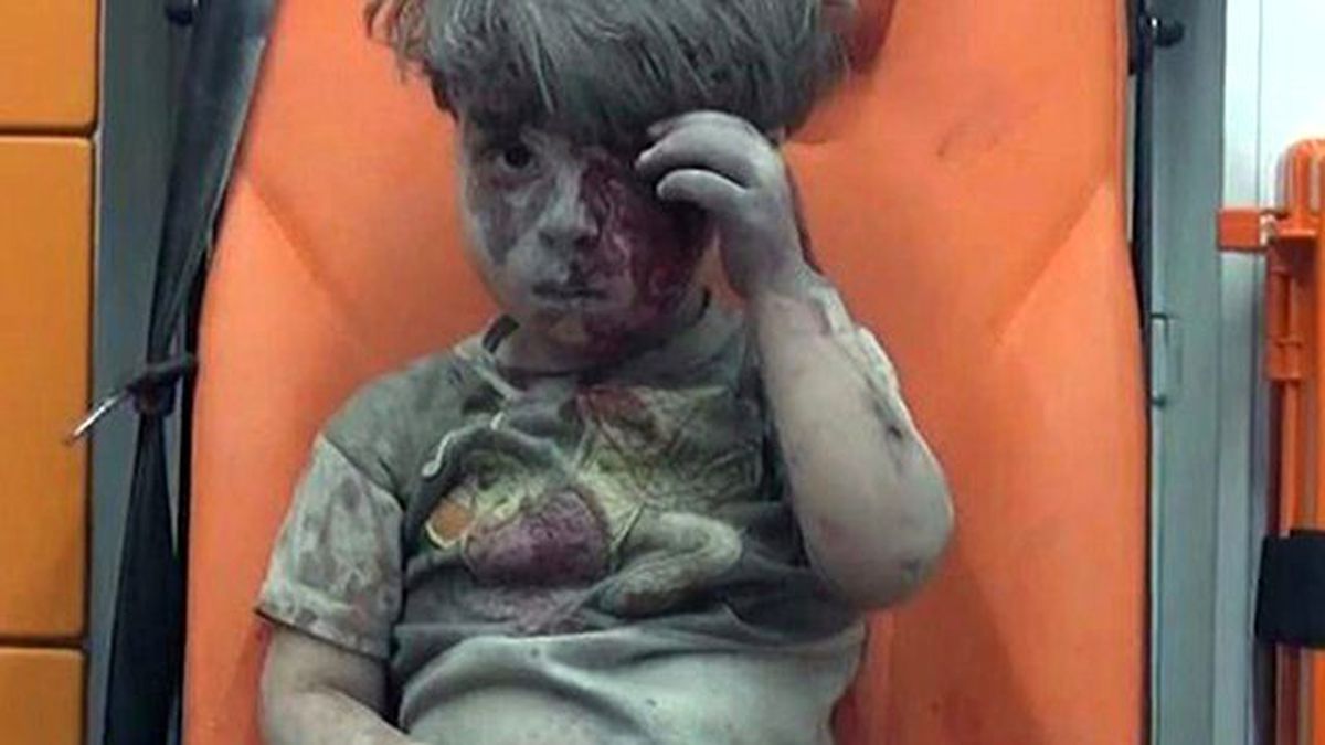 Halep'te Rejim Uçaklarının Bombardımanından Yaralı Kurtulan Ümran'ın Ağabeyi Öldü