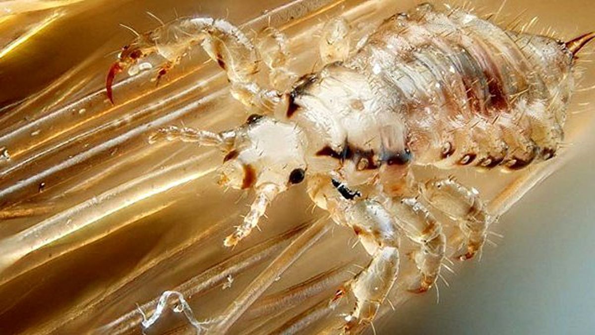 Dubai'de Saç Uzatmak İçin Bitlendirme Uygulaması Yapılıyor