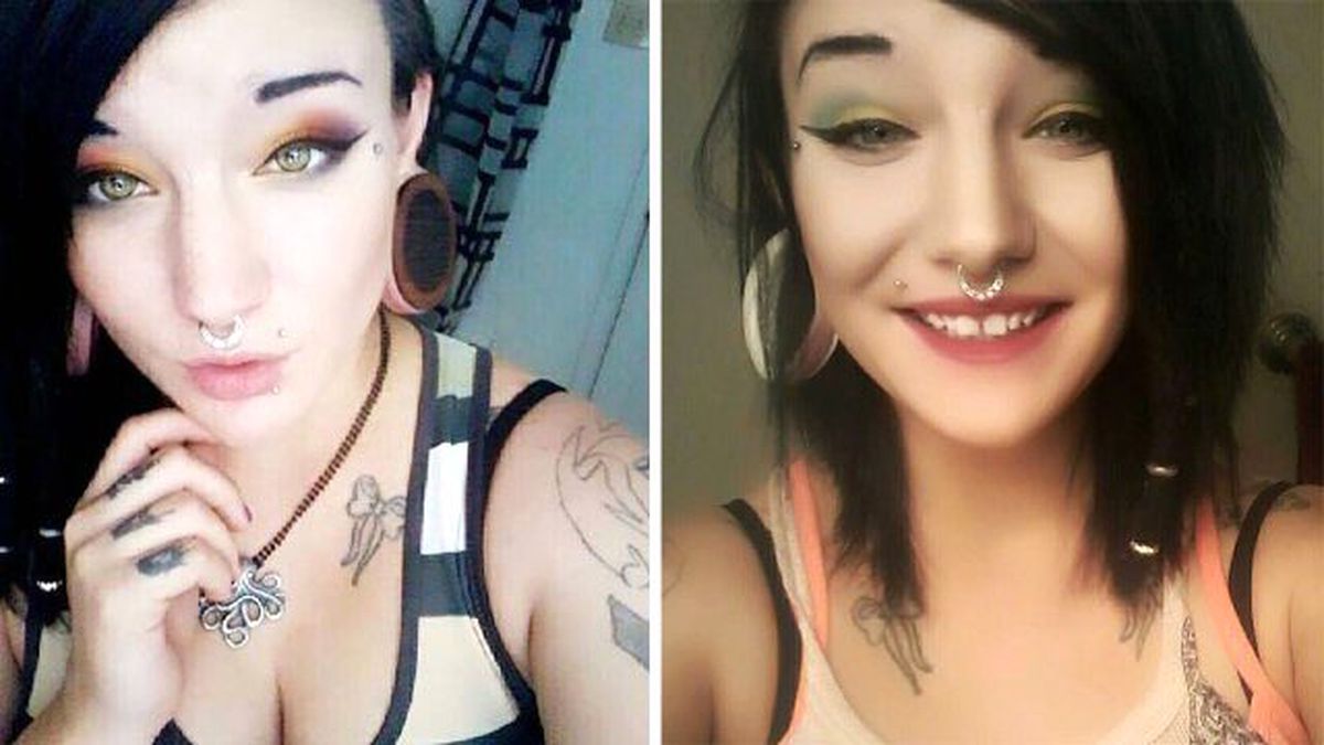 Sezaryen İzlerini Paylaştı, Sosyal Medyada Olay Yarattı