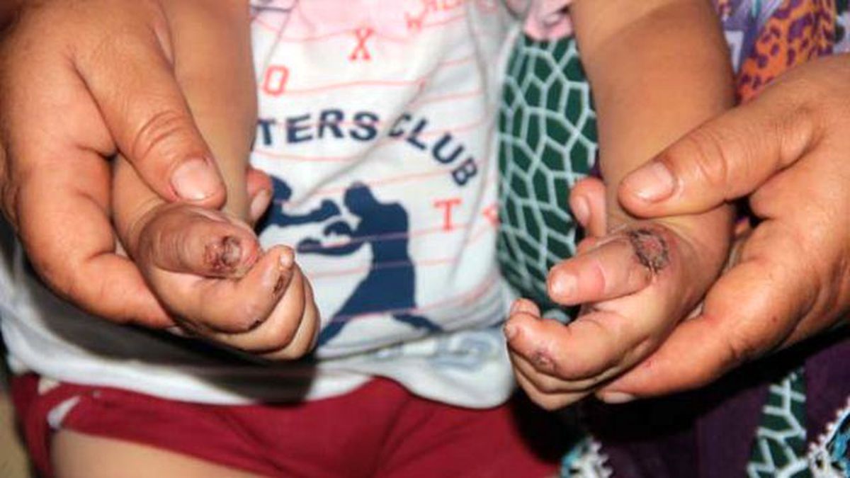 Isırarak Kendine Zarar Veren Bebeğin Ailesi Yardım İstedi