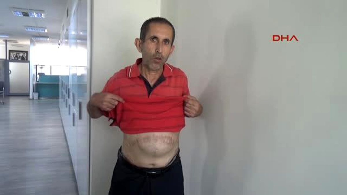 Adana Hastalıklarla Mücadele Ederken Emekli Olabilmek İçin Dava Açtı