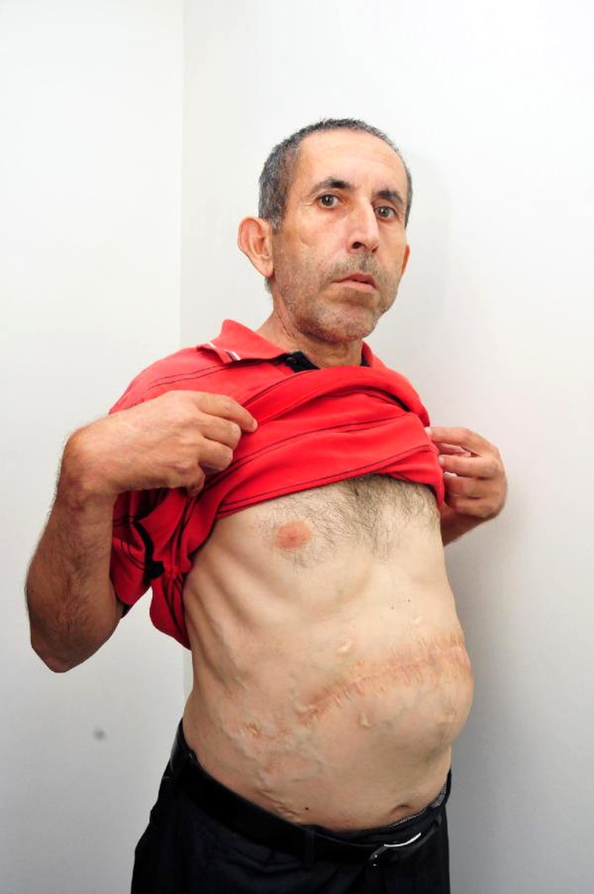 Hastalıklarla Mücadele Ederken Emekli Olabilmek İçin Dava Açtı