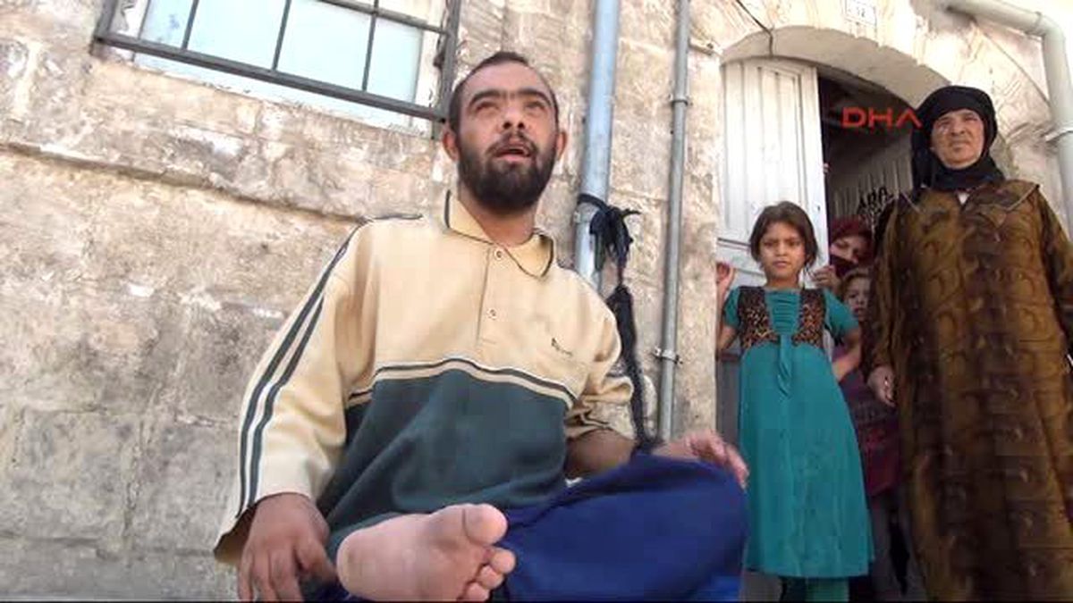 Şanlıurfa Suriyeli Engelli Genç İple Su Borusuna Bağlandı