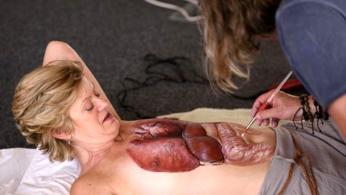 Organ Bağışına Dikkat Çekmek İçin Soyundu