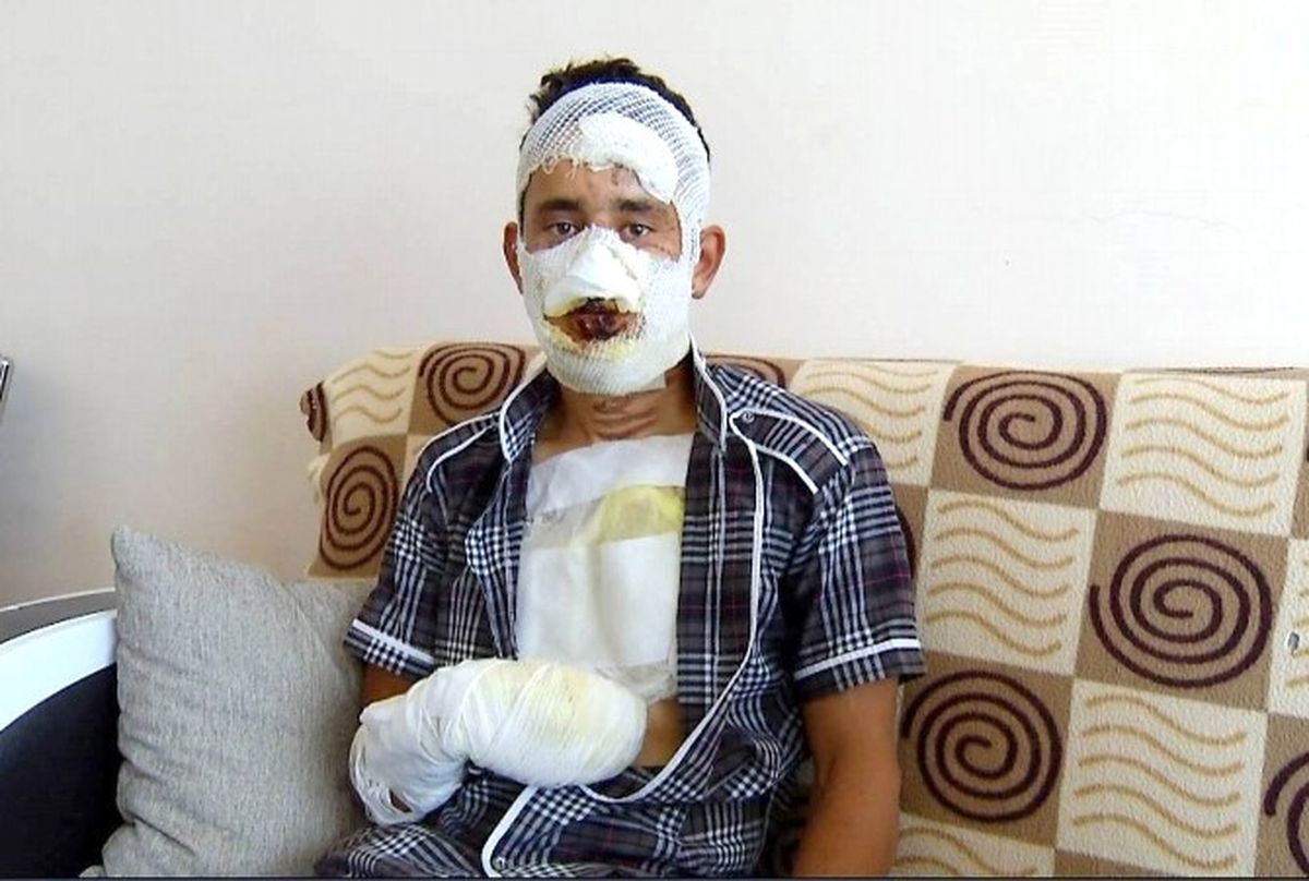 Terhisine 2 Ay Kalan Askeri 4 Arkadaşı Öldüresiye Dövüp Yaktı!