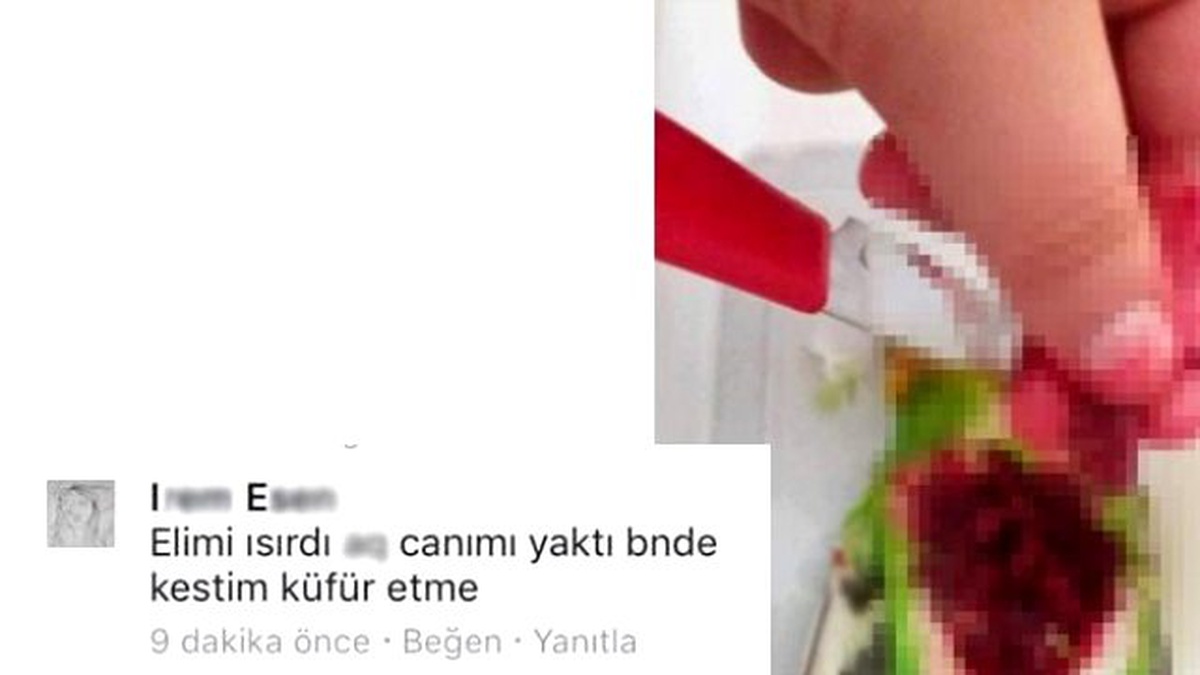 Parmağını Isıran Papağanın Kalbini Söküp Facebook\'tan Paylaştı!