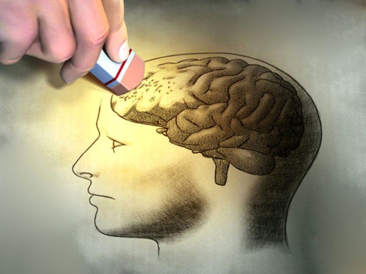 21 Eylül Dünya Alzheimer Günü Mesajı