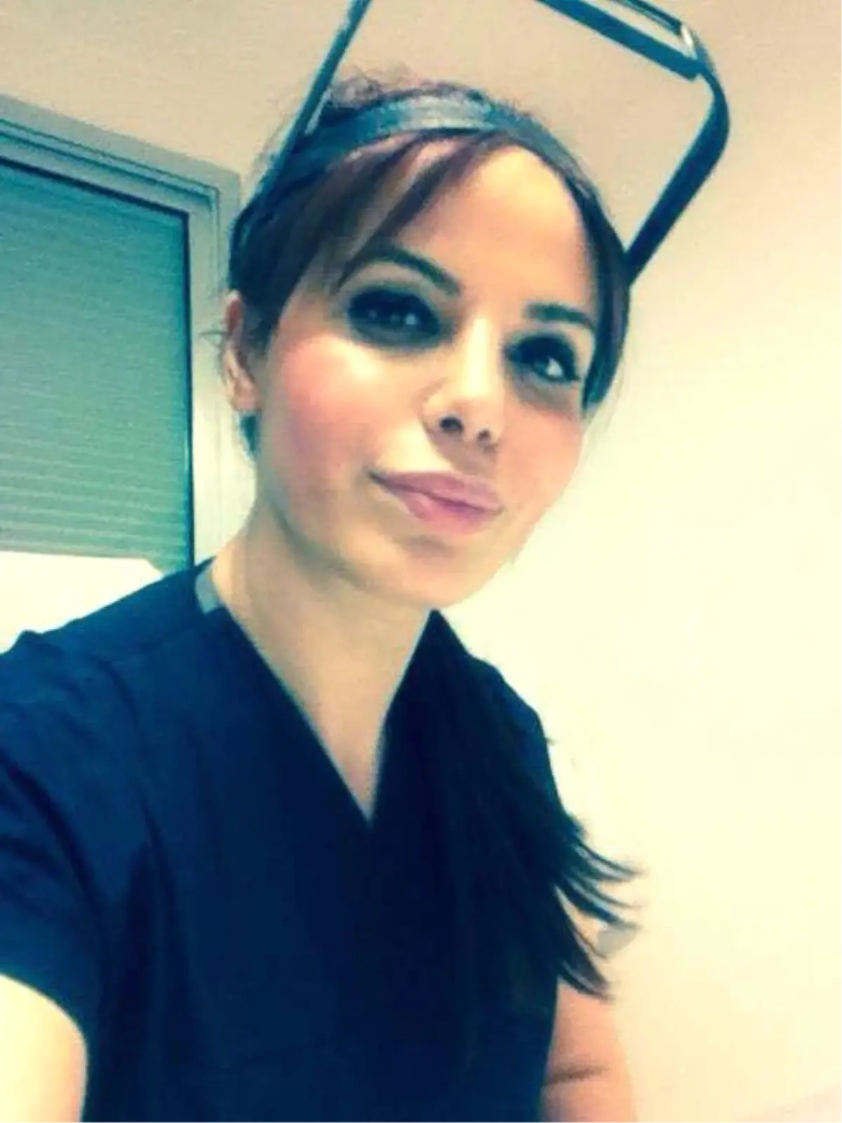 Erkeklerde Saç Dökülmesi Psikolojiyi Bozuyor