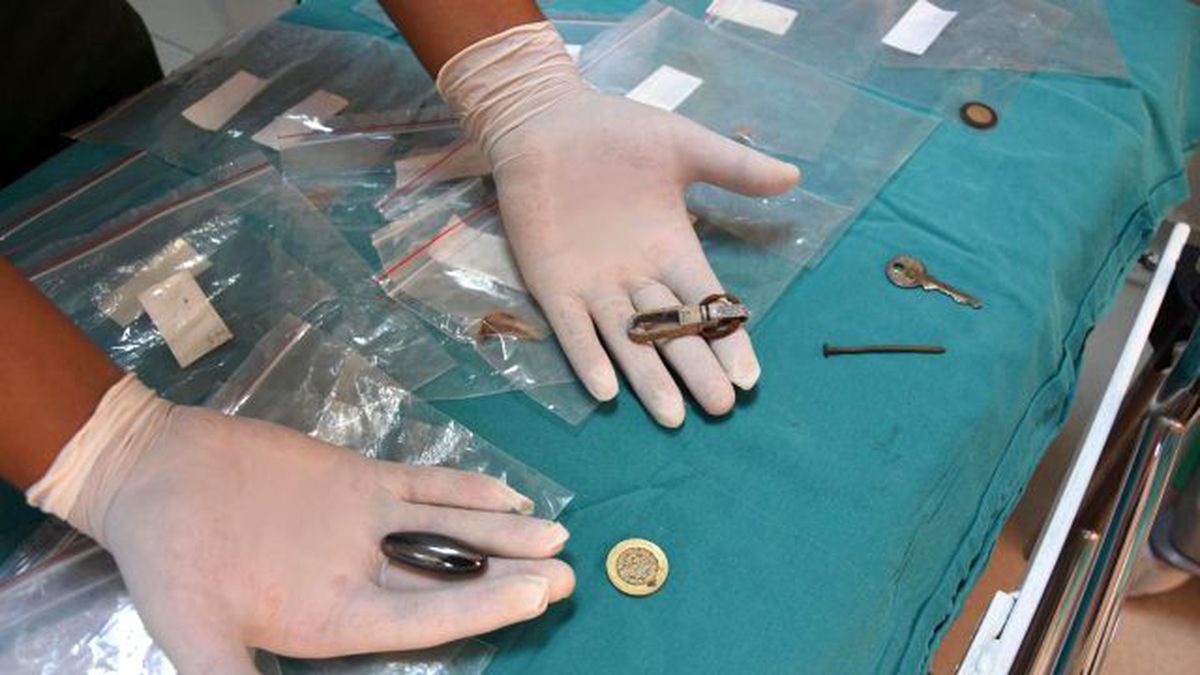 Çocukların Yuttuğu Cisimler Şaşkına Çevirdi