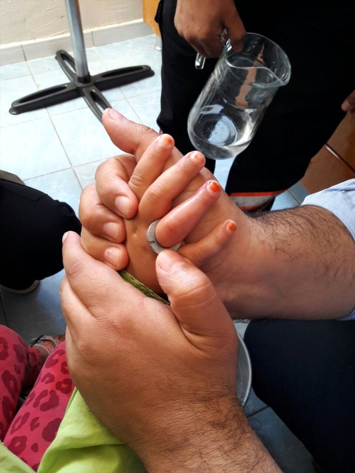 Metal Pula Sıkışan Parmağını İtfaiye Kurtardı