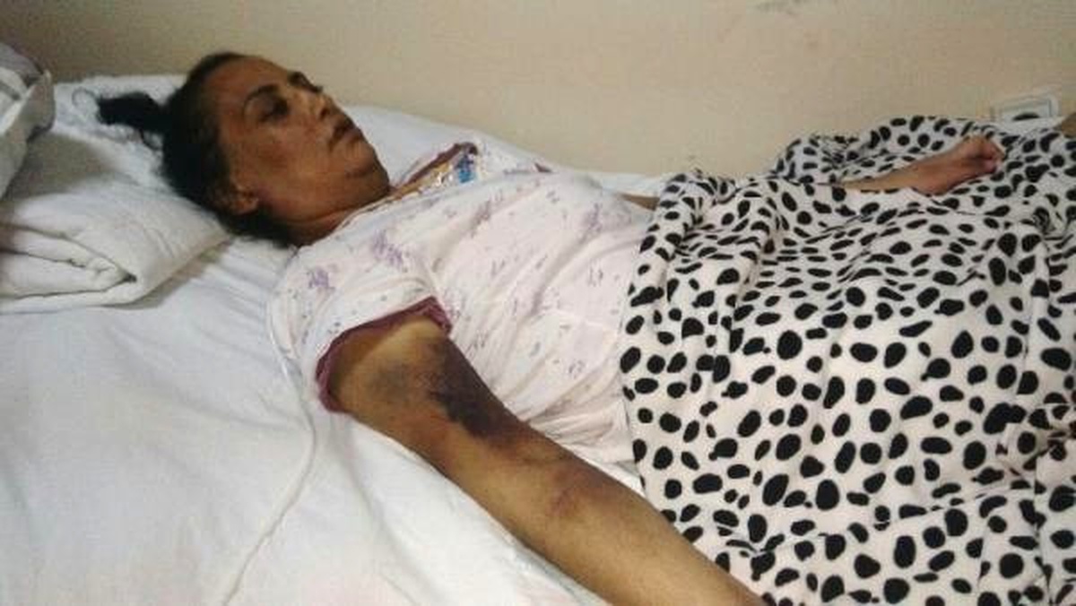 Mide Küçültme Ameliyatının Ardından Felç Geçirdi