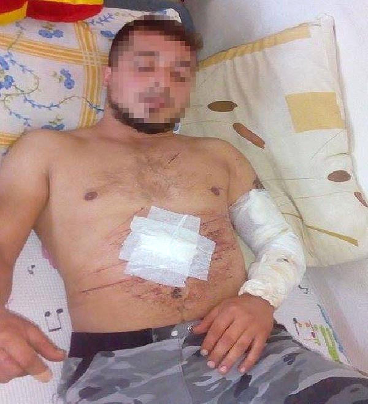 Bira Şişesiyle Kendini Kesti