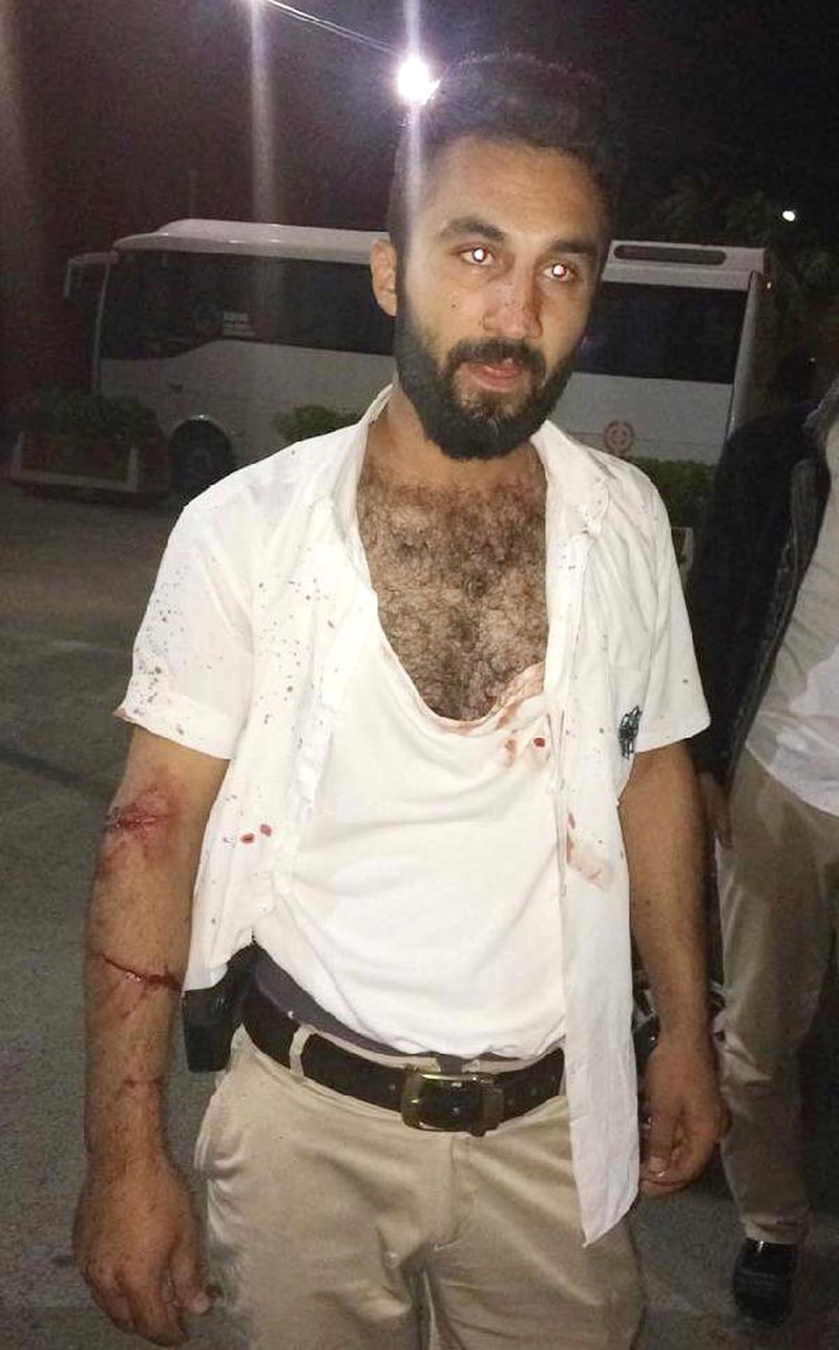 Belediye Otobüs Şoförü, Uyardığı Baba-Oğul Tarafından Dövülerek Bıçaklandı